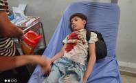 غزة تودّع شهداءها تحت نيران القصف والمجاعة