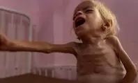 فصائل المقاومة: إعلان المجاعة في غزة يحمّل المجتمع الدولي مسؤولية التدخل الفوري لكسر الحصار