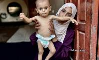 الحصار يتواصل على غزة وسط تجويع متعمد ومطالب بفتح المعابر فورًا