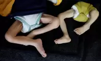 202404mena_palestine_gaza_starvation_children