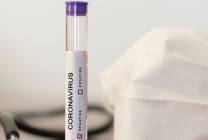 coronavirus-negative