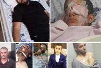 عائلة حنايشة في قباطية: الأجهزة الأمنية أطلقت النار على المدنيين والأطفال وقنابل الغاز على النساء