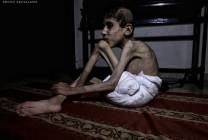 اليوم الـ 268 للإبادة: توسيع استهداف النازحين والجوع ينهش أطفال غزة
