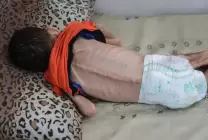 نفاد غذاء الأطفال في غزة وتحذيرات أممية من المجاعة 