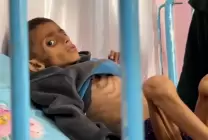 الحصار يفتك بأطفال غزة: استشهاد 66 طفلاً نتيجة سوء التغذية 