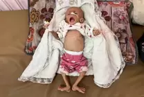شهيد الجوع الثاني خلال 24 ساعة في قطاع غزة 