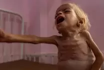 فصائل المقاومة: إعلان المجاعة في غزة يحمّل المجتمع الدولي مسؤولية التدخل الفوري لكسر الحصار