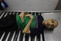 4 وفيات جديدة بسبب التجويع والحصار في غزة