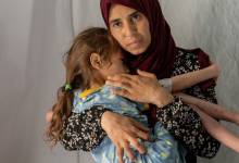 أطباء بلا حدود: سوء التغذية غير مسبوق في غزة وتجويع متعمد للنساء والأطفال