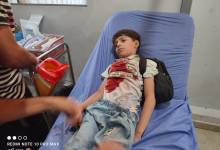 غزة تودّع شهداءها تحت نيران القصف والمجاعة