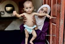 الحصار يتواصل على غزة وسط تجويع متعمد ومطالب بفتح المعابر فورًا