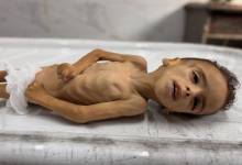 الصحة في غزة: 500 رضيع يصارعون الجوع وسوء التغذية