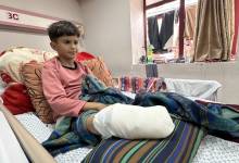 21 ألف طفل في غزة أُصيبوا بإعاقات دائمة