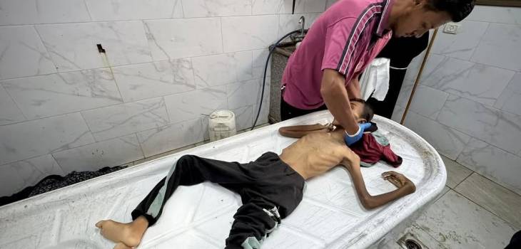 الجوع يقتل 4 بينهم طفلان خلال ساعات بقطاع غزة 