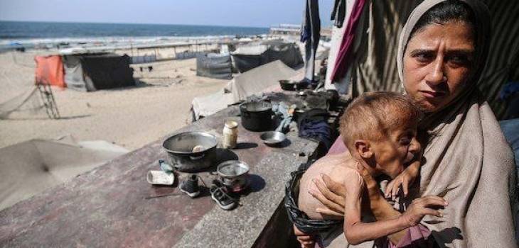 9 شهداء بينهم أطفال بالتجويع المستمر لقطاع غزة 