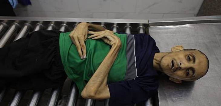 4 وفيات جديدة بسبب التجويع والحصار في غزة