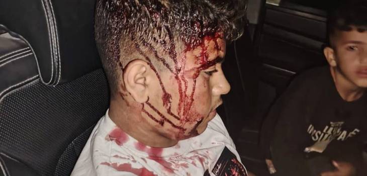 20 إصابة في اعتداءات المستوطنين جنوب الخليل وحملة اعتقالات واسعة في سلفيت 