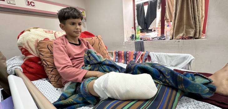 21 ألف طفل في غزة أُصيبوا بإعاقات دائمة