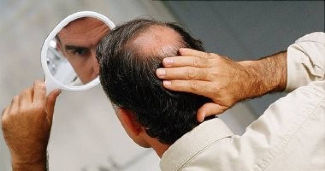 صلع