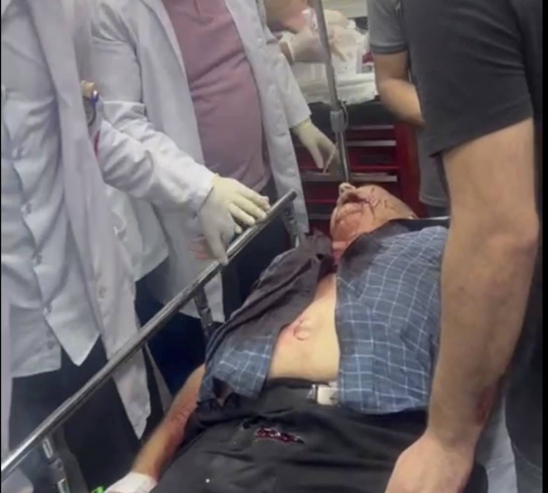 استشهاد مسن بطوباس وطفل بنابلس