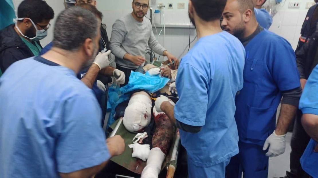 استهداف جديد للصحفيين في قطاع غزة. إصابة الزميلين إسماعيل أبو عمر وأحمد مطر