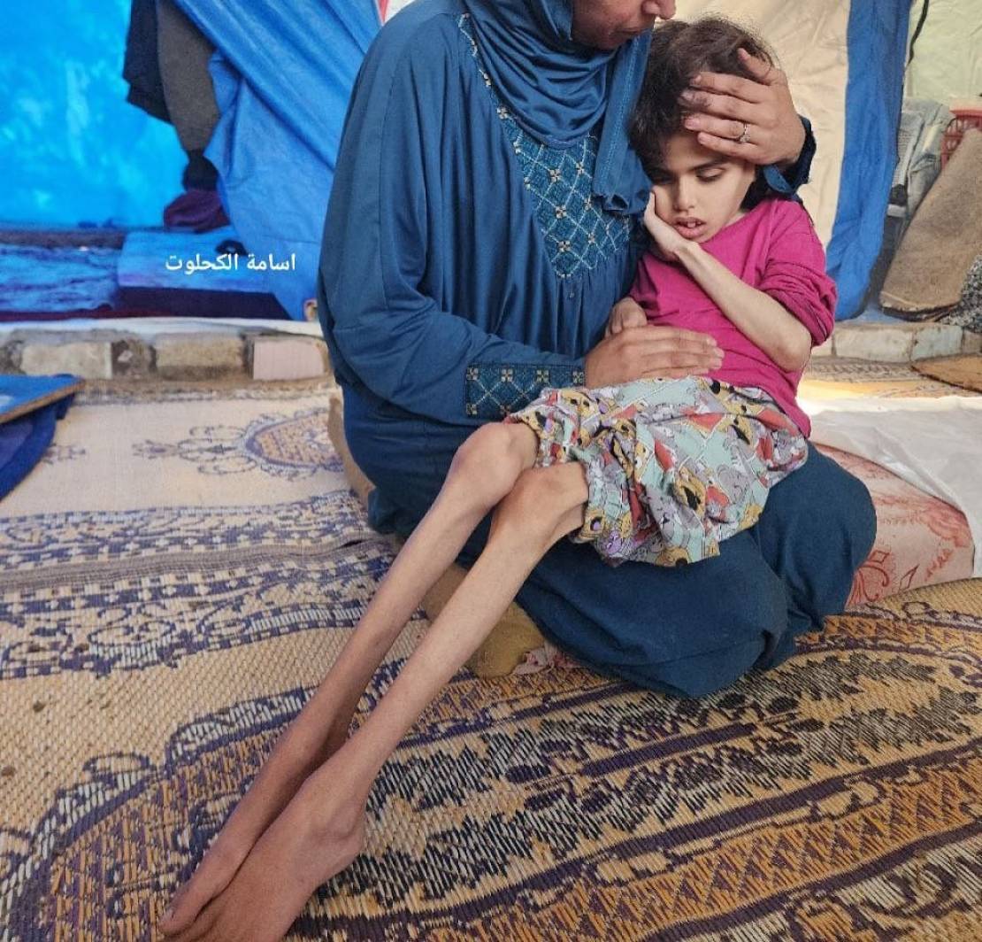 في اليوم الـ50 من استئناف الإبادة: الاستشهاد قصفًا وجوعًا 