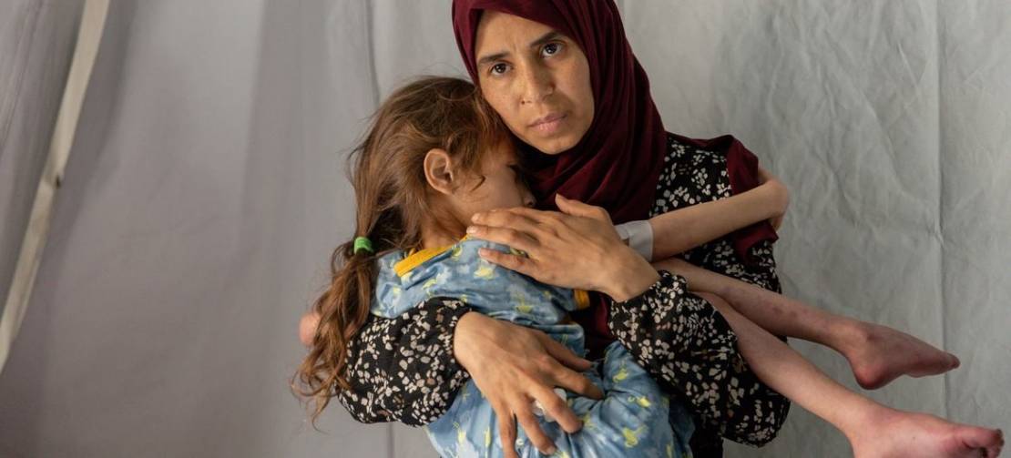 أطباء بلا حدود: سوء التغذية غير مسبوق في غزة وتجويع متعمد للنساء والأطفال