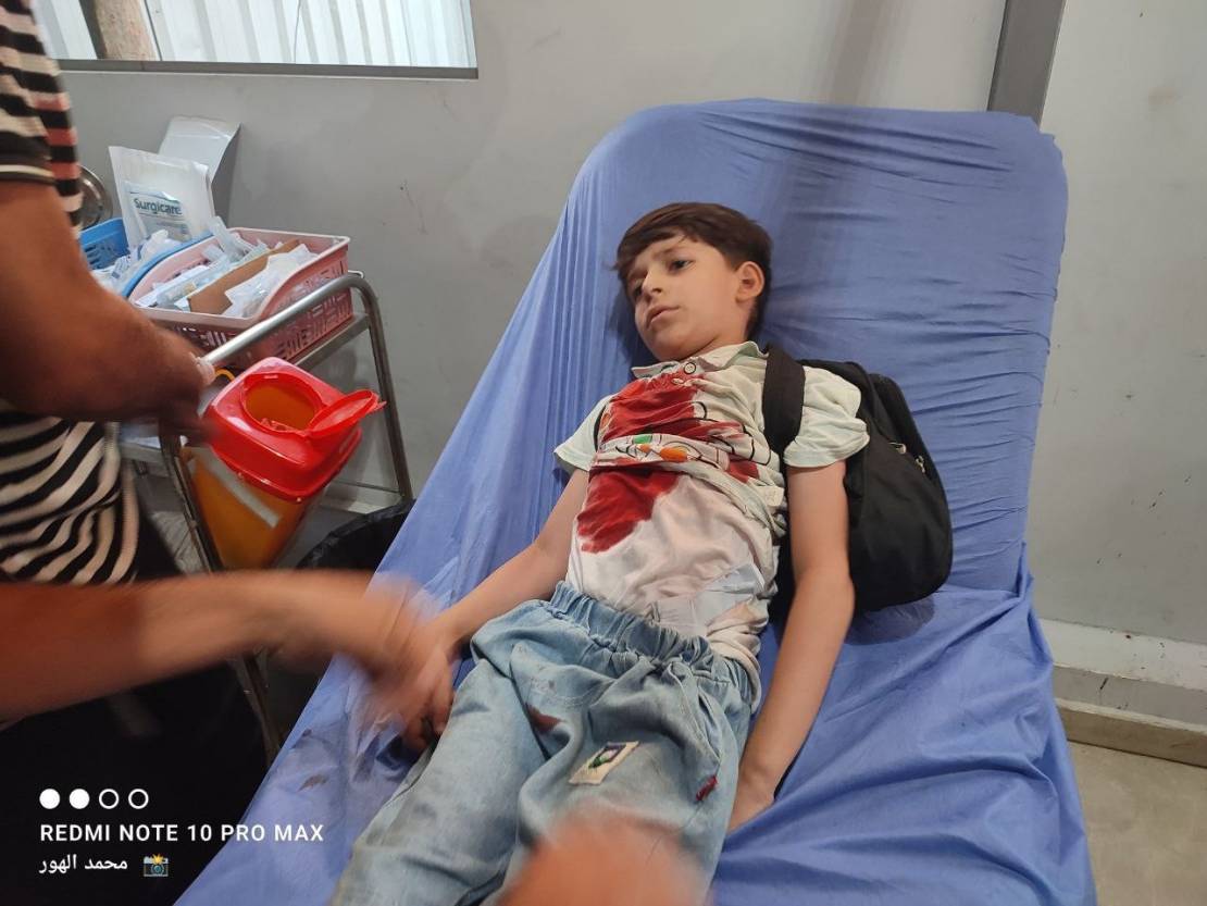 غزة تودّع شهداءها تحت نيران القصف والمجاعة