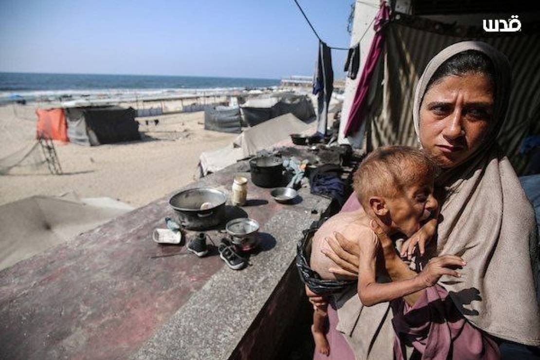 9 شهداء بينهم أطفال بالتجويع المستمر لقطاع غزة 