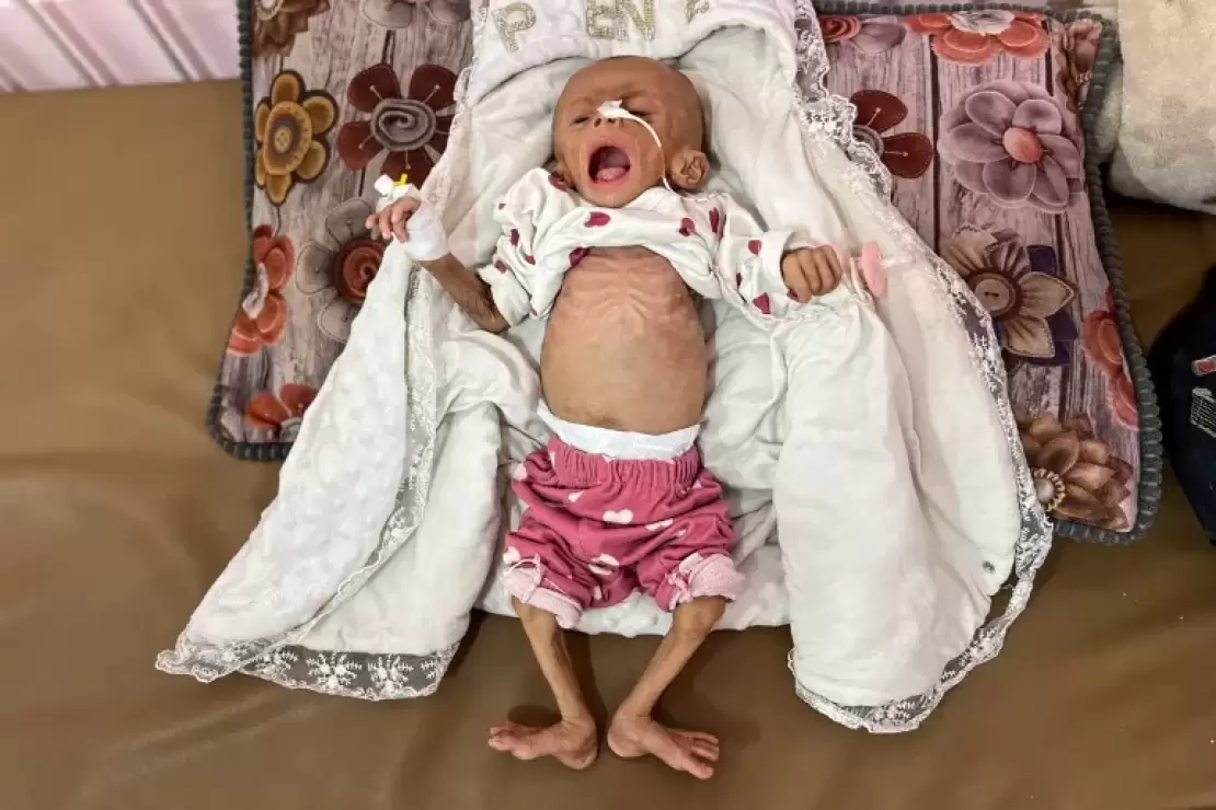 شهيد الجوع الثاني خلال 24 ساعة في قطاع غزة 