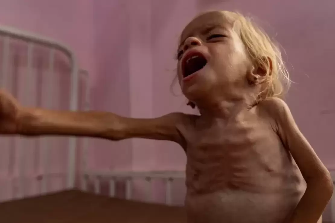 فصائل المقاومة: إعلان المجاعة في غزة يحمّل المجتمع الدولي مسؤولية التدخل الفوري لكسر الحصار