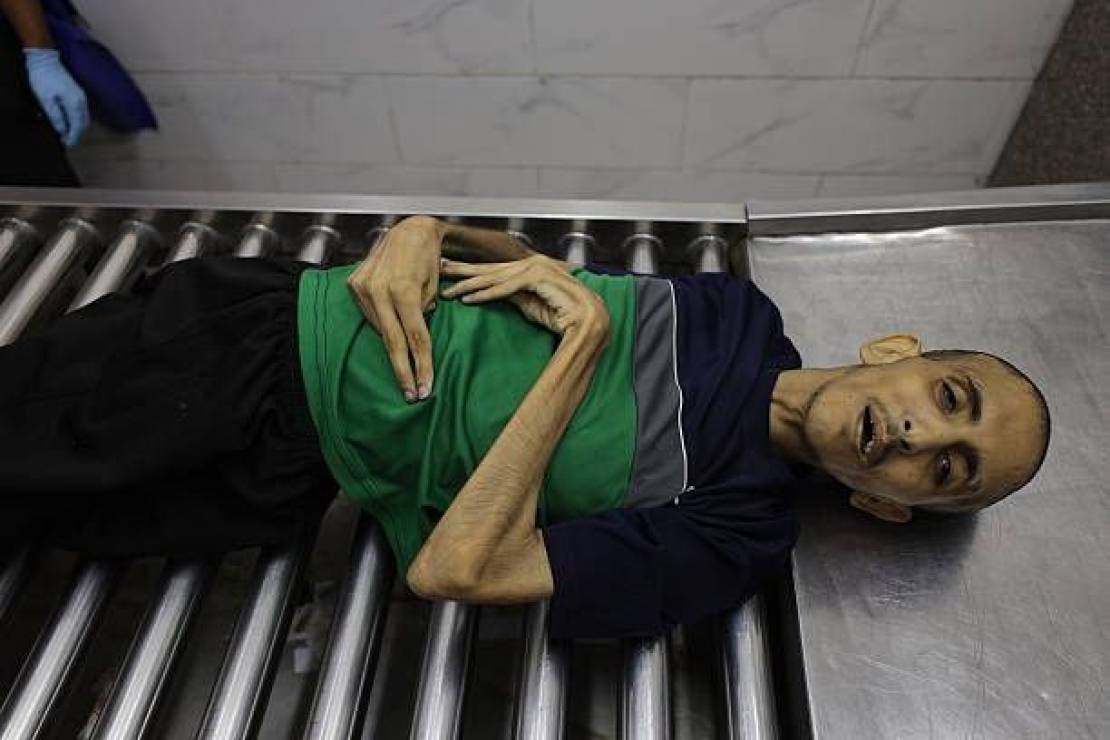4 وفيات جديدة بسبب التجويع والحصار في غزة
