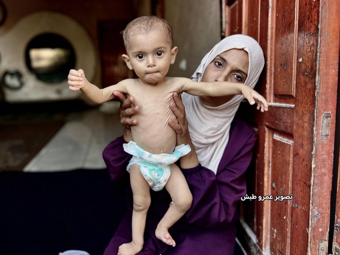 الحصار يتواصل على غزة وسط تجويع متعمد ومطالب بفتح المعابر فورًا