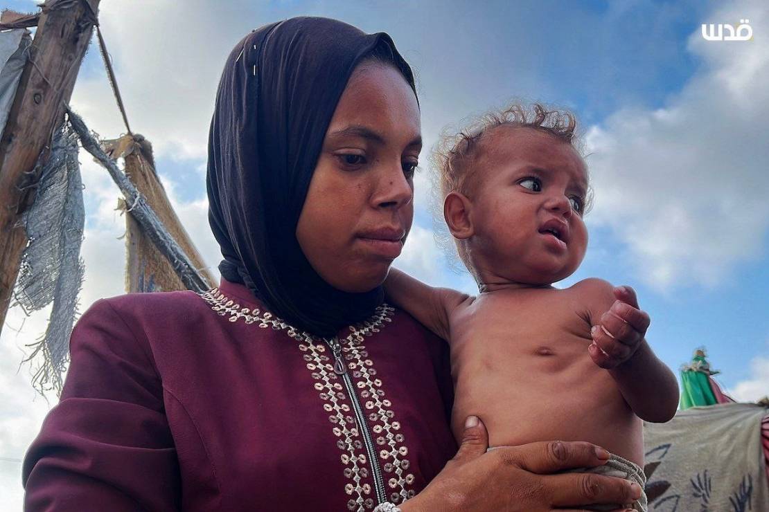 8 شهداء تجويعًا في غزة والأونروا تحذر من كارثة تطال مليون طفل تحت الحصار
