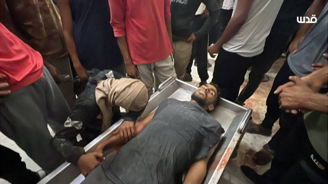 شهداء وجرحى في قصف الاحتلال منازل ومخيمات النازحين في غزة 