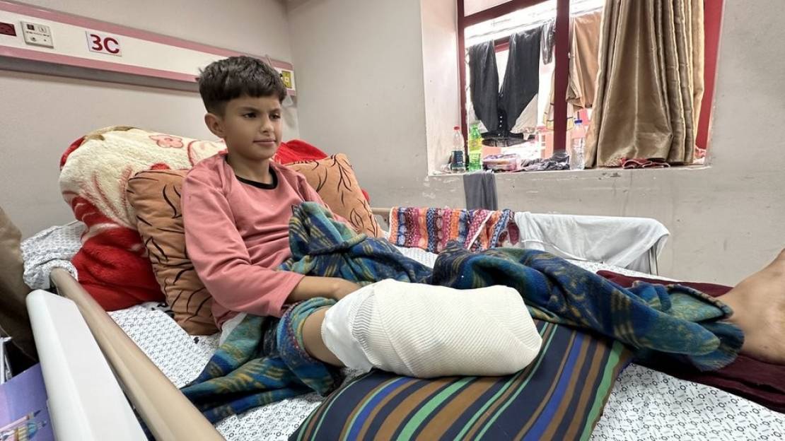 21 ألف طفل في غزة أُصيبوا بإعاقات دائمة