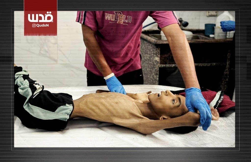 ارتفاع عدد شهداء المجاعة في غزة إلى 111 